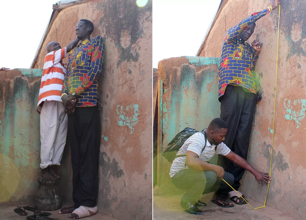 Kugira ngo ibipimo bye bifatwe byasabye ko abaforomo bisunga ibyo guhagararaho
